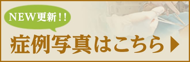 症例写真はこちら